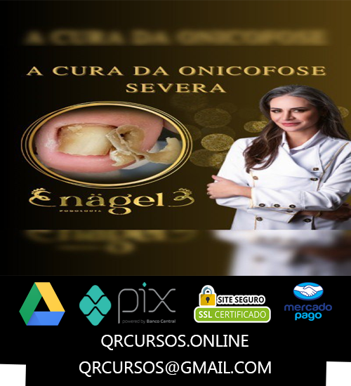 A Cura da Onicofose Severa - Nagel Cursos