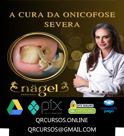 A Cura da Onicofose Severa - Nagel Cursos
